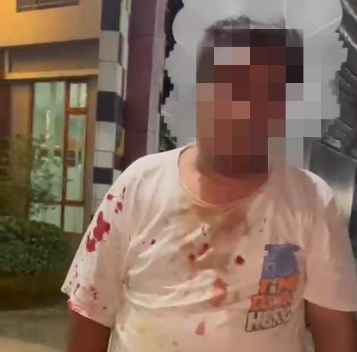 Luka di Era Modern: Pengeroyokan di Situ Cikedal Menguji Ketegasan Aparat dan Komitmen Kantor Hukum PKBB & Partner Dampingi Korban